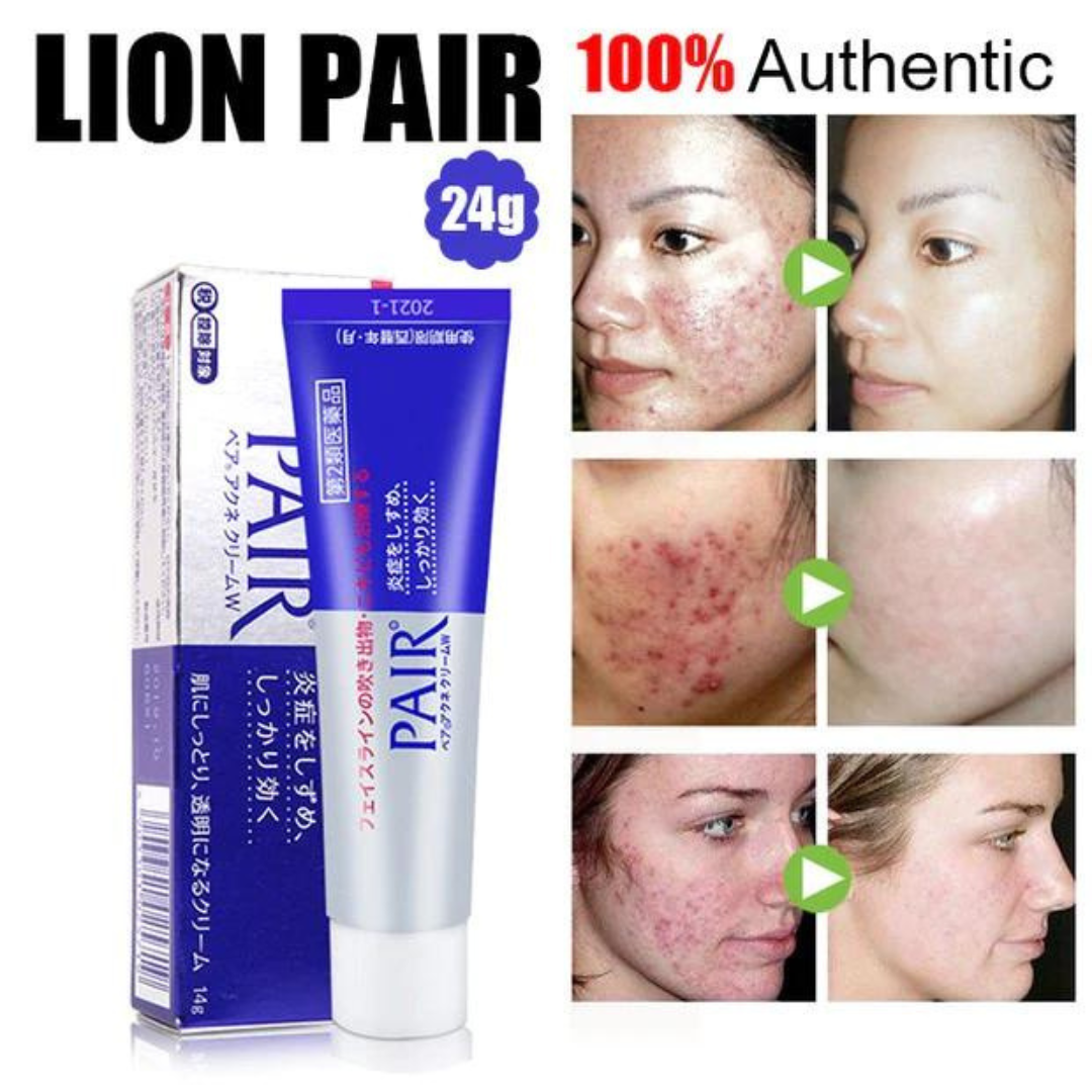 LION Pair Acne Cream W 14 g
