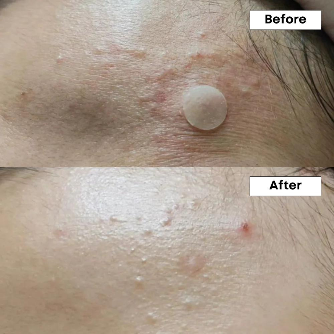 NINE LESS A-Control 10% Azelaic Acid Serum