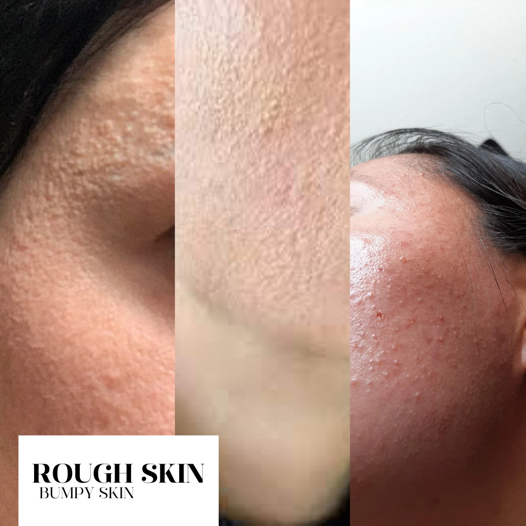 MY SKIN JOURNEY | YOUR CUSTOM SHEET MASKS BOX