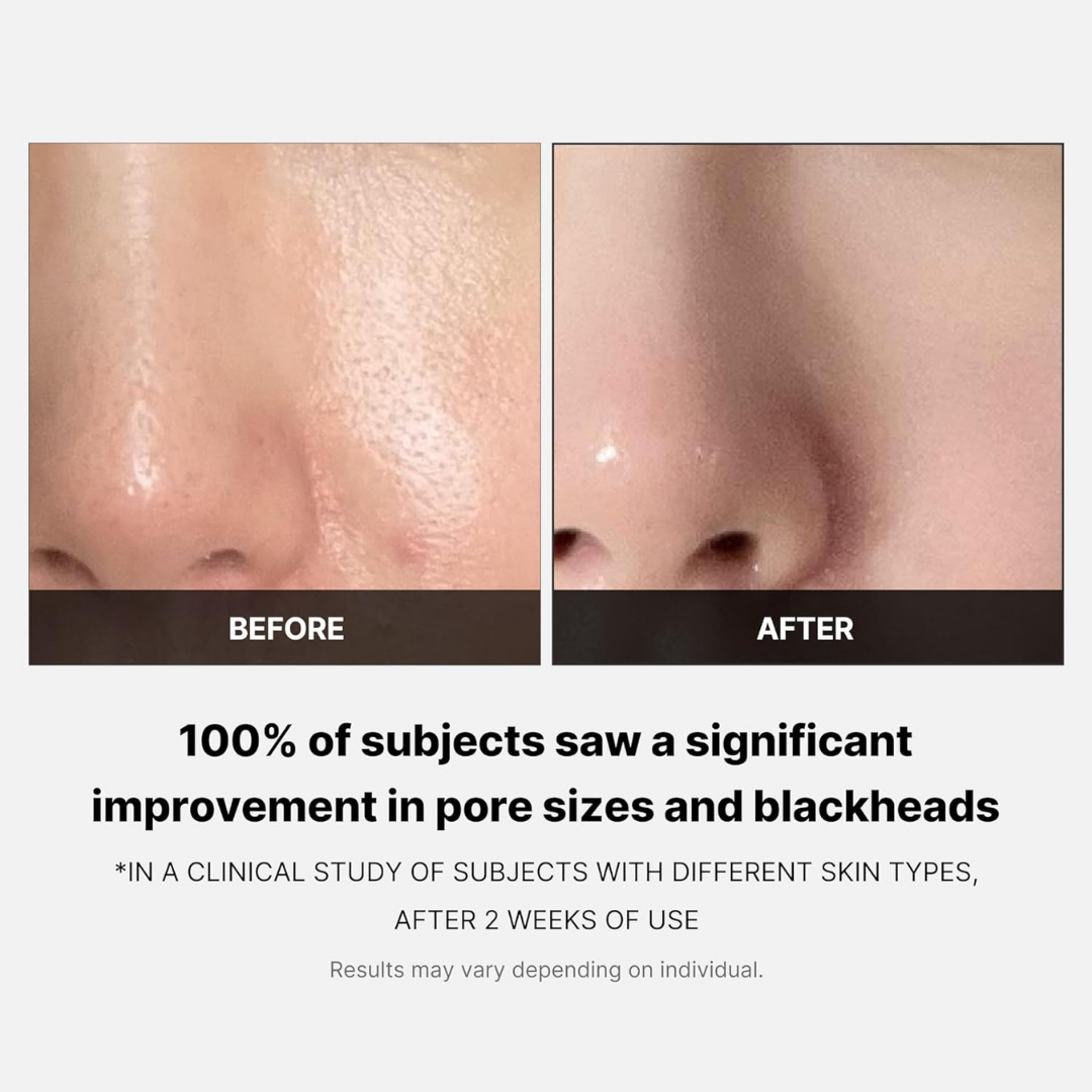 MEDICUBE Zero Pore Pads 2.0