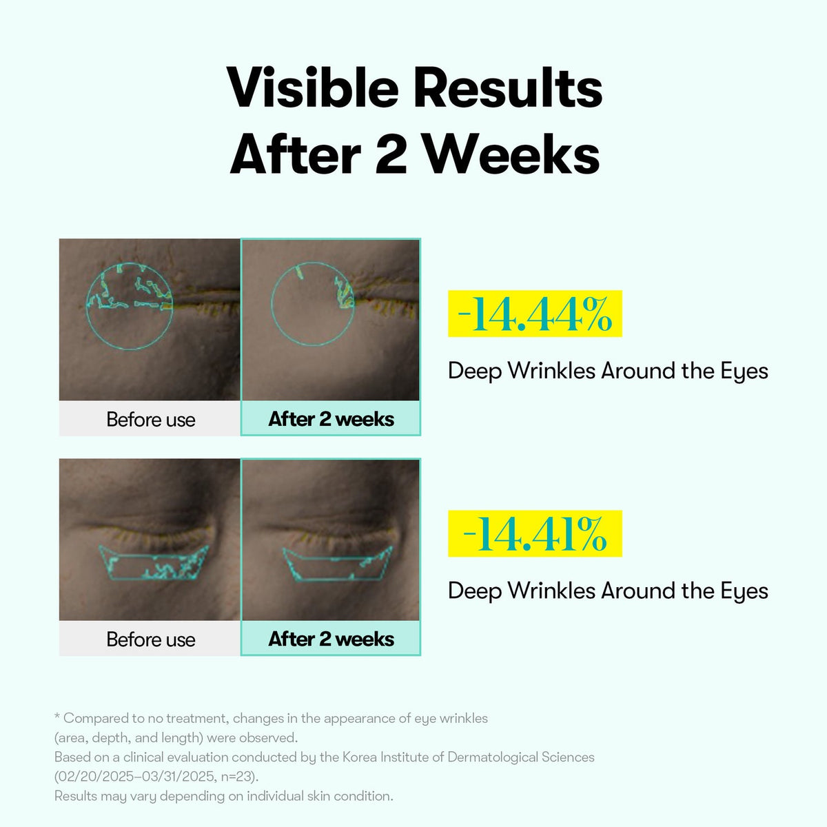 VT PDRN Reedle Shot Firming Eye Lifter