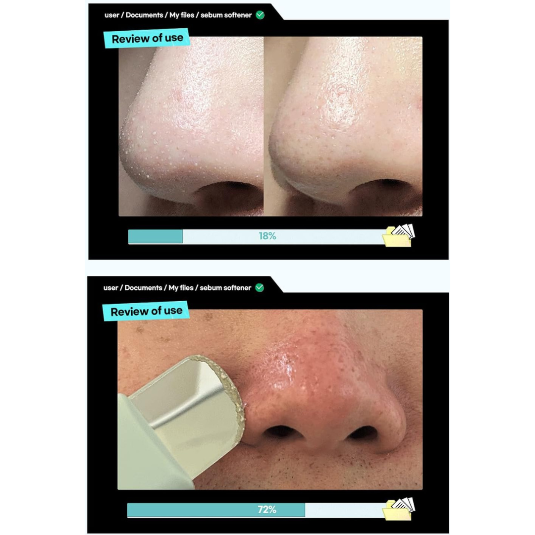 ILSO Super Melting Sebum Softener