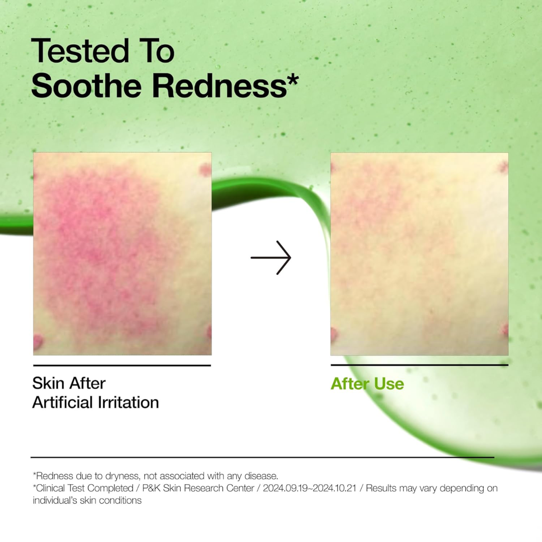 ANUA Azelaic Acid 10 Hyaluron Redness Soothing Serum