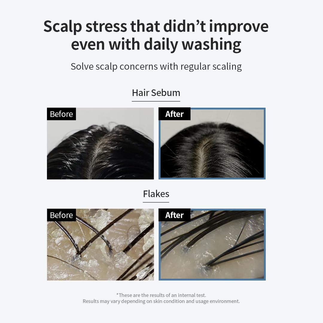 GROWUS Sea Salt Therapy Scalp Scaler