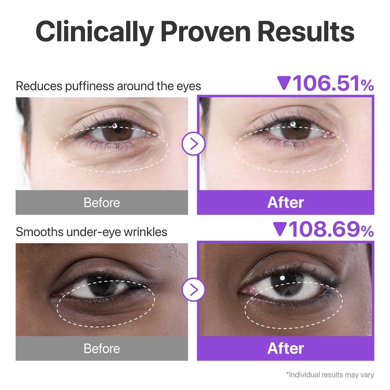 NUMBUZIN No.9 NAD Collagen Under Eye Patches