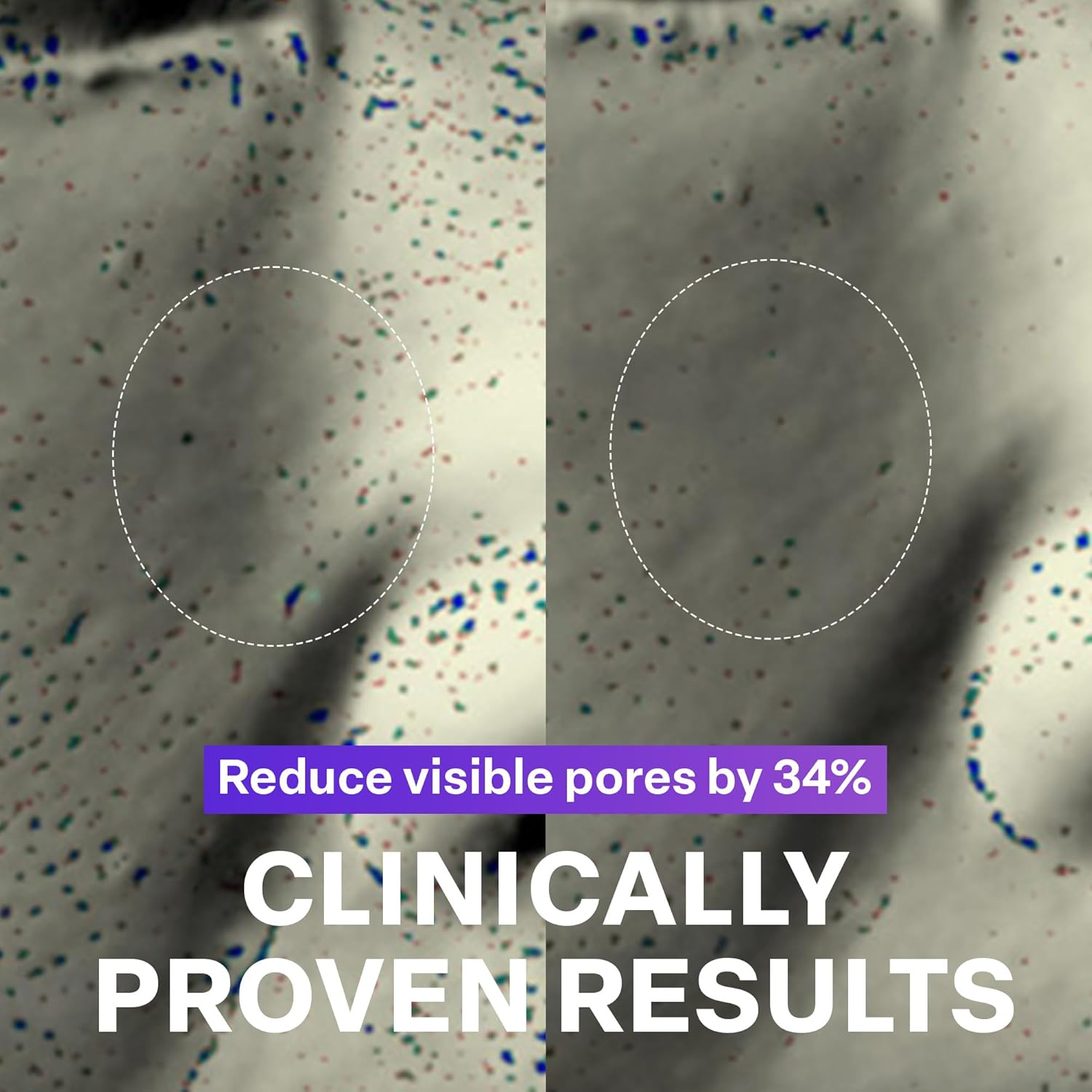 PURCELL Pixcell Biom™ Glow Barrier Serum