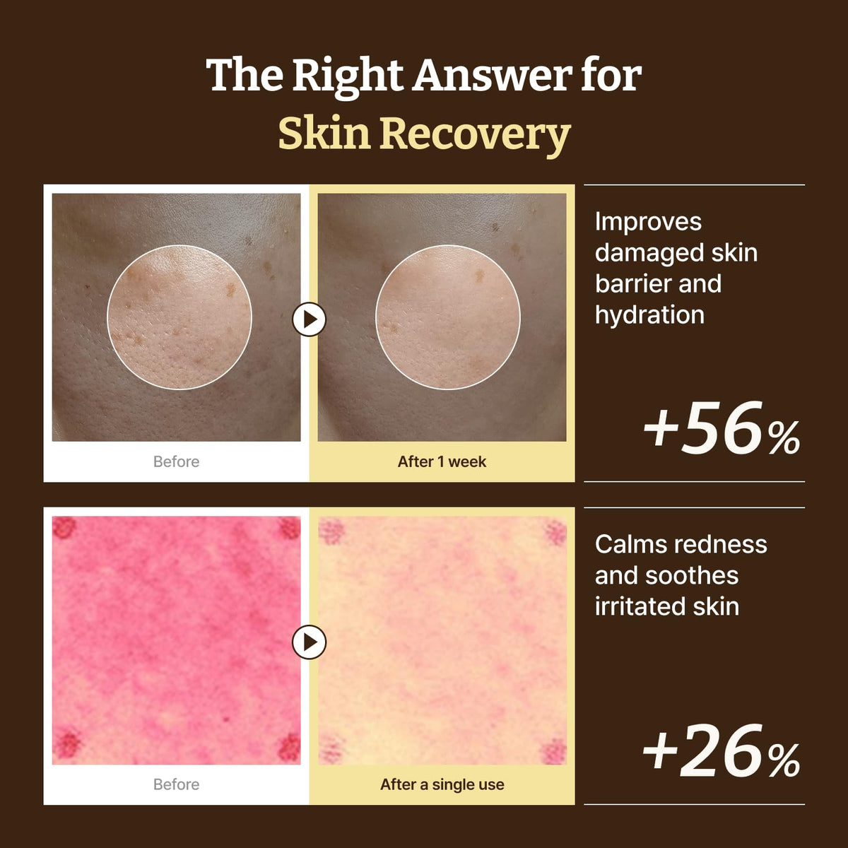 DR.REJU-ALL Advanced PDRN Rejuvenating Cream