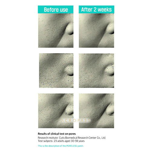 ACROPASS Poreless Pore care