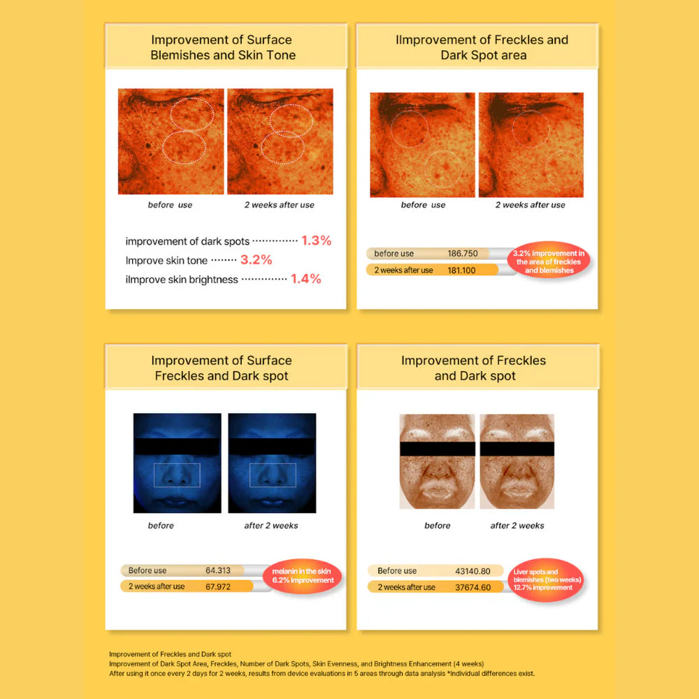 ACROPASS Dark spot Care