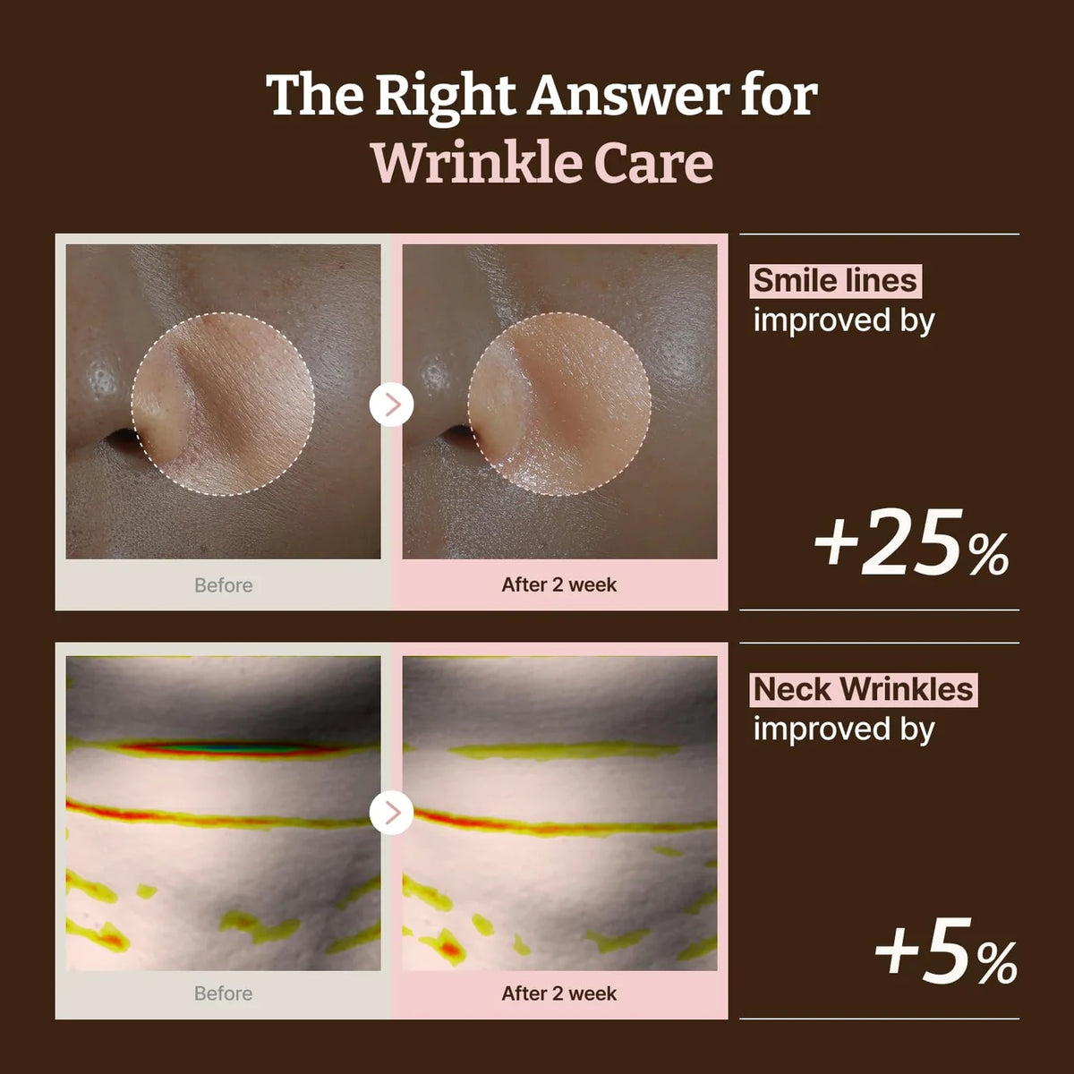 DR.REJU-ALL Advanced PDRN Rejuvenating Mask